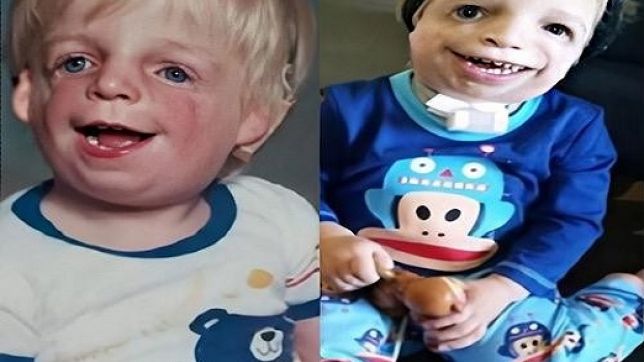 Abandonado por ser ‘feio demais’, ele cresceu, se tornou milionário e hoje namora uma linda mulher