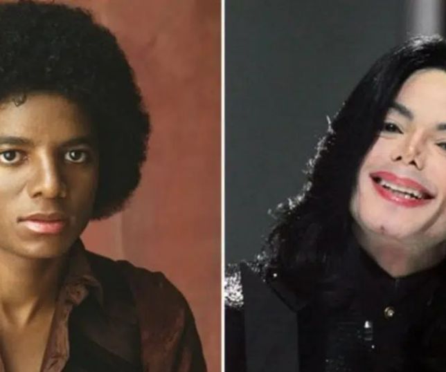 Notícias Por que a pele de Michael Jackson ficou branca quando ele envelheceu Portal do