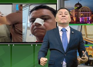 'A BRONCA DO ZACA': CASTIGO DE DEUS: Adenilson Reis, que ficou rico pilhando os cofres da Prefeitura de Nova Olinda do Norte, fratura o nariz quando fazia campanha antecipada para deputado estadual. VEJA FOTOS