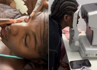 Modelo perde visão por 7 dias após ter córneas queimadas por pomada de cabelo