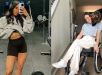 O que é Babesiose, doença transmitida pelo carrapato que deixou influenciadora fitness parcialmente paralisada