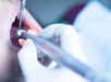 Dentista faz procedimentos estéticos irregulares e deforma pacientes