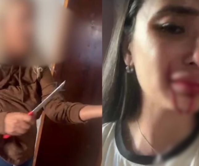 Ex-dançarina  é ferida após ser atingida por faca em ataque da mãe. VEJA VÍDEO
