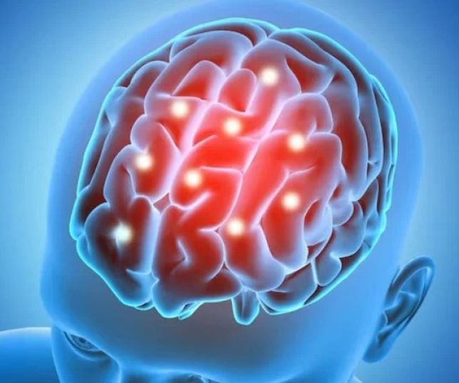 Surto de meningite no Rio Grande do Sul: saiba quais são os sintomas e como se proteger