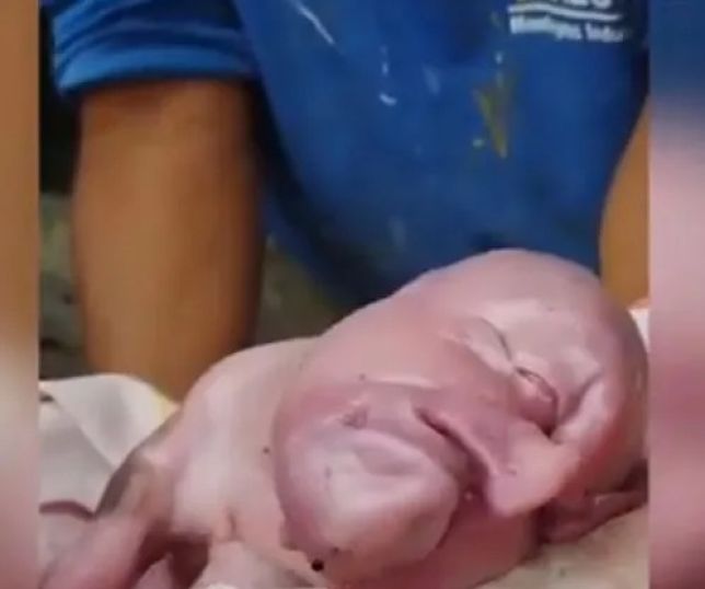 Leitão nasce com múltiplas anomalias e choca criadores. VEJA VÍDEO