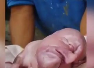 Leitão nasce com múltiplas anomalias e choca criadores. VEJA VÍDEO