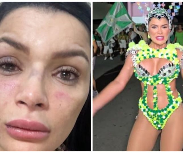 Musa da escola de samba aparecida sofre agressão física e tentativa de assalto praticado por motociclista de aplicativo e um comparsa na Zona Centro-sul de Manaus. VEJA VÍDEO