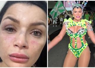 Musa da escola de samba aparecida sofre agressão física e tentativa de assalto praticado por motociclista de aplicativo e um comparsa na Zona Centro-sul de Manaus. VEJA VÍDEO