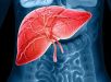 Hepatologista revela o que fazer para evitar o colapso do fígado