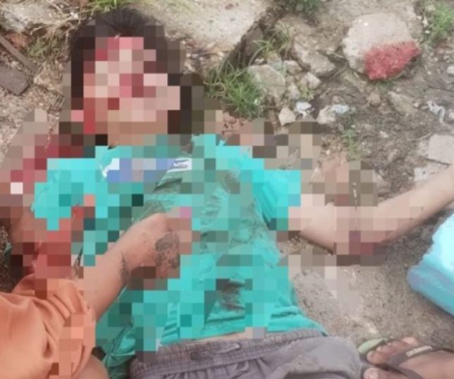 IMAGENS FORTES! Motociclista fica ferido após colisão e suspeito foge sem prestar socorro no bairro do Jorge Teixeira, Zona Leste de Manaus. VEJA VÍDEO