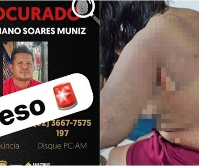 Polícia prende homem que ateou fogo na ex-companheira e no filho do casal em Parintins, interior do Amazonas. VEJA VÍDEOS