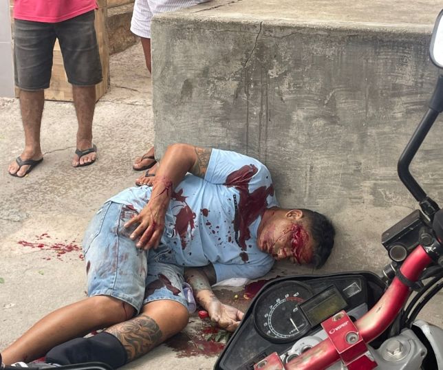 IMAGENS FORTES! Execução à luz do dia: homem com tornozeleira eletrônica é morto a tiros no bairro do Salgado, em Caruaru. VEJA VÍDEO