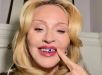 Madonna exibe joia dental de diamantes criada por designer brasileira