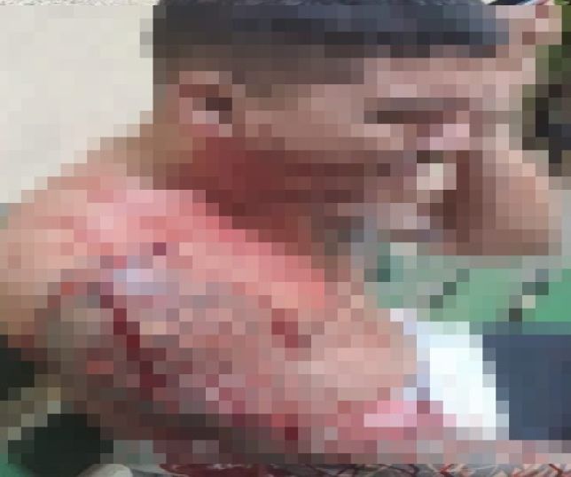 IMAGEM FORTE! Esposa encontra mensagem de outra mulher no celular do marido e tenta matá-lo a facadas no bairro Lago Azul, Zona Norte de Manaus