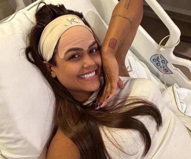 Camila Loures revela procedimento para remover veia da testa e especialistas explicam técnica