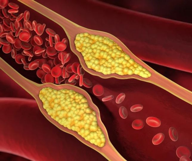 Artérias saudáveis: hábitos diários que ajudam a evitar o acúmulo de gordura e proteger o coração