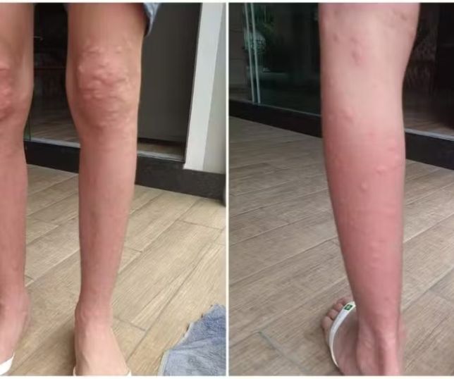 Infestação de maruim obriga moradores de cidade em Santa Catarina a se trancarem em casa no calor