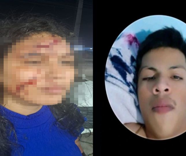 IMAGENS FORTES! Mulher é atacada com prato quebrado pelo ex-companheiro e enfrenta dificuldade para denunciar em Manaus