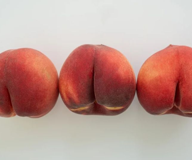 Um lado do bumbum maior? Entenda como hábitos do dia a dia causam assimetria