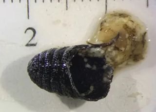 Mulher espirra ''vermes'' pelo nariz e médicos identificam infecção rara causada por larvas de mosca