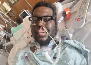 Homem perde braços e pernas após infecção grave depois de ida ao dentista