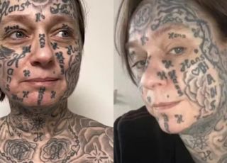 Mulher forçada a tatuar nome do ex mais de 250 vezes consegue remover marcas após anos de violência