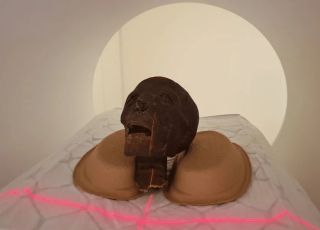 Tomografias de múmias revelam sinais de osteoporose e surpreendem cientistas sobre doenças antigas