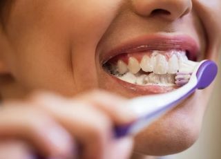 Escovar os dentes antes ou depois do café? Especialistas esclarecem o melhor momento