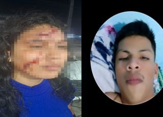 IMAGENS FORTES! Mulher é atacada com prato quebrado pelo ex-companheiro e enfrenta dificuldade para denunciar em Manaus