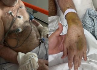 Idoso é contido com amarras em hospital do Distrito Federal e caso vira alvo de investigação