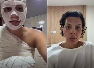 Nutricionista tem 33% do corpo queimado após explosão com saco de lixo durante tarefa doméstica. VEJA VÍDEO