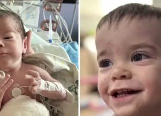 Menino que nasceu com órgãos fora do corpo passa por tratamento inovador com uso de Botox