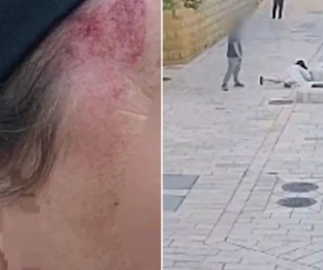 Freira é atacada em Jerusalém e suspeito é preso por possível motivação racista. VEJA VÍDEO
