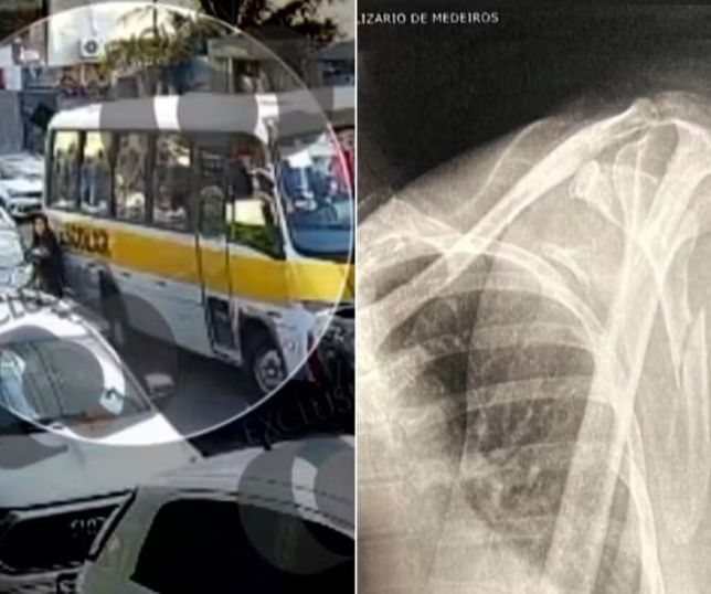 Mulher fica prensada entre ônibus escolar e carro em Goiás; vídeo mostra desespero. VEJA 