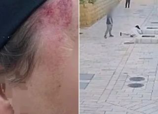 Freira é atacada em Jerusalém e suspeito é preso por possível motivação racista. VEJA VÍDEO