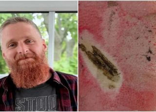 Bateria de vape explode no bolso e homem sofre queimaduras graves na Escócia