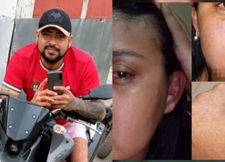 Ex-rainha do Guaraná afirma ter sido espancada pelo ex-companheiro e denuncia caso em Maués, interior do Amazonas