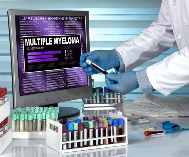 Estudo propõe mudar critério para identificar casos mais graves de mieloma múltiplo