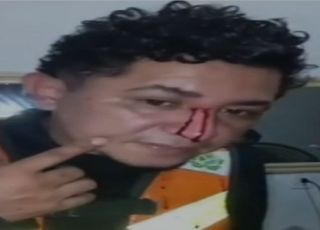 PERIGO NO TRÂNSITO! Motociclista escapa de ser degolado por linha com cerol no município de Tefé, interior do Amazonas. VEJA VÍDEO
