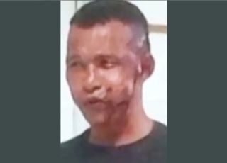 Homem joga soda cáustica no rosto da ex após ela denunciar descumprimento de medida protetiva na Bahia