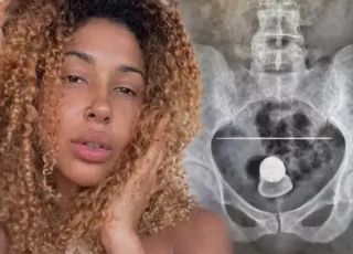 Influenciadora é internada após incidente com plug e faz alerta sobre cuidados