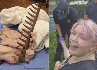 Mulher fica com o pé preso em ancinho enferrujado ao caminhar descalça em jardim de casa