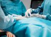 Tratamento minimamente invasivo elimina tumor no fígado com uso de calor e permite alta rápida