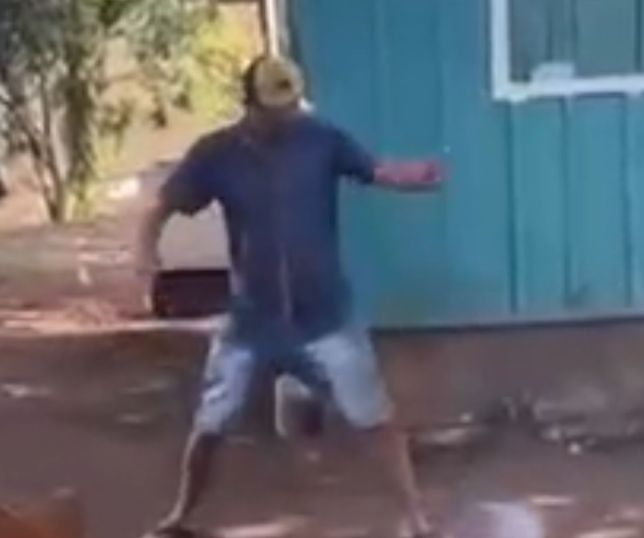 IMAGENS FORTES! Homem tem o pé 'estourado' após pisar em bombinha de rojão e cena impressiona pela violência da explosão. VEJA VÍDEO