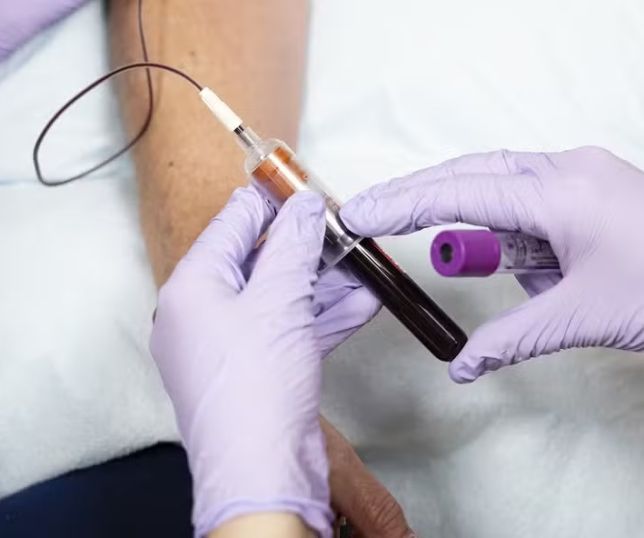 Novo medicamento promete reduzir drasticamente o colesterol ruim; veja como funciona