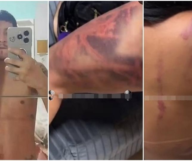Homem é denunciado e pode ter prisão preventiva decretada após cárcere privado e violentas agressões contra ex-companheira no bairro Compensa, Zona Oeste de Manaus