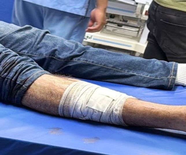 Capitão da Polícia Militar é atingido com tiro na perna durante evento de campanha do govenador Roberto Cidade no bairro Novo Israel, Zona Norte de Manaus
