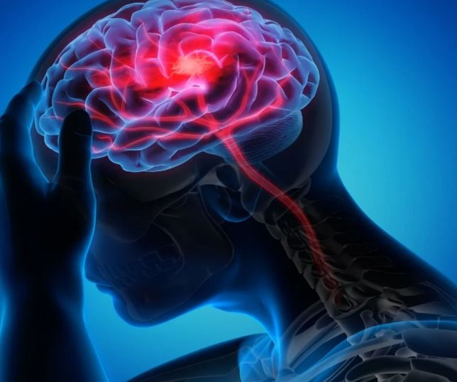 Biomaterial injetável mostra potencial para reparar cérebro após AVC