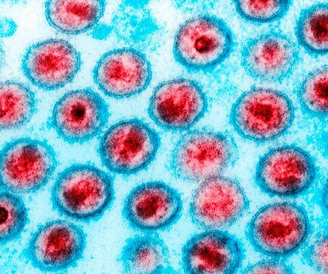 Medicamento contra o câncer reduz células infectadas pelo HIV em estudo