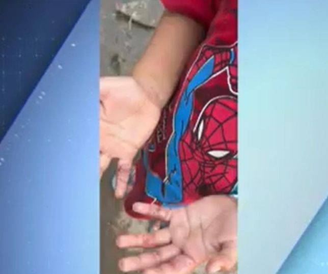 Menino de 5 anos é resgatado após suspeita de maus-tratos em Manaus